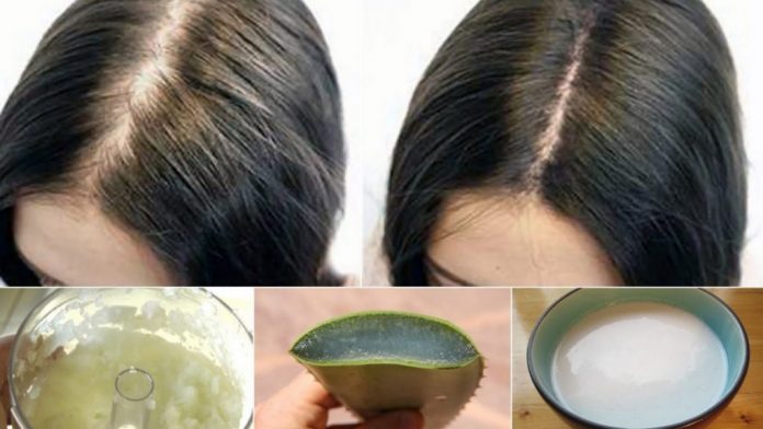 Natural Hair loss Home Remedies for Pakistani Girls