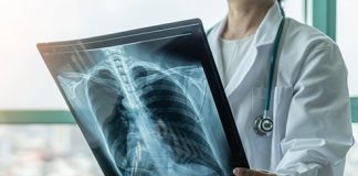 Asthma Specialist Doctors in Pakistan
