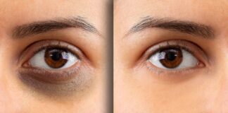 Best under eye cream