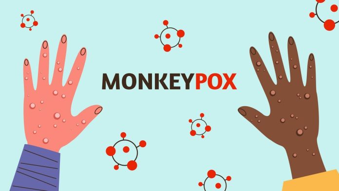 What is Monkeypox and How to save yourself in Pakistan